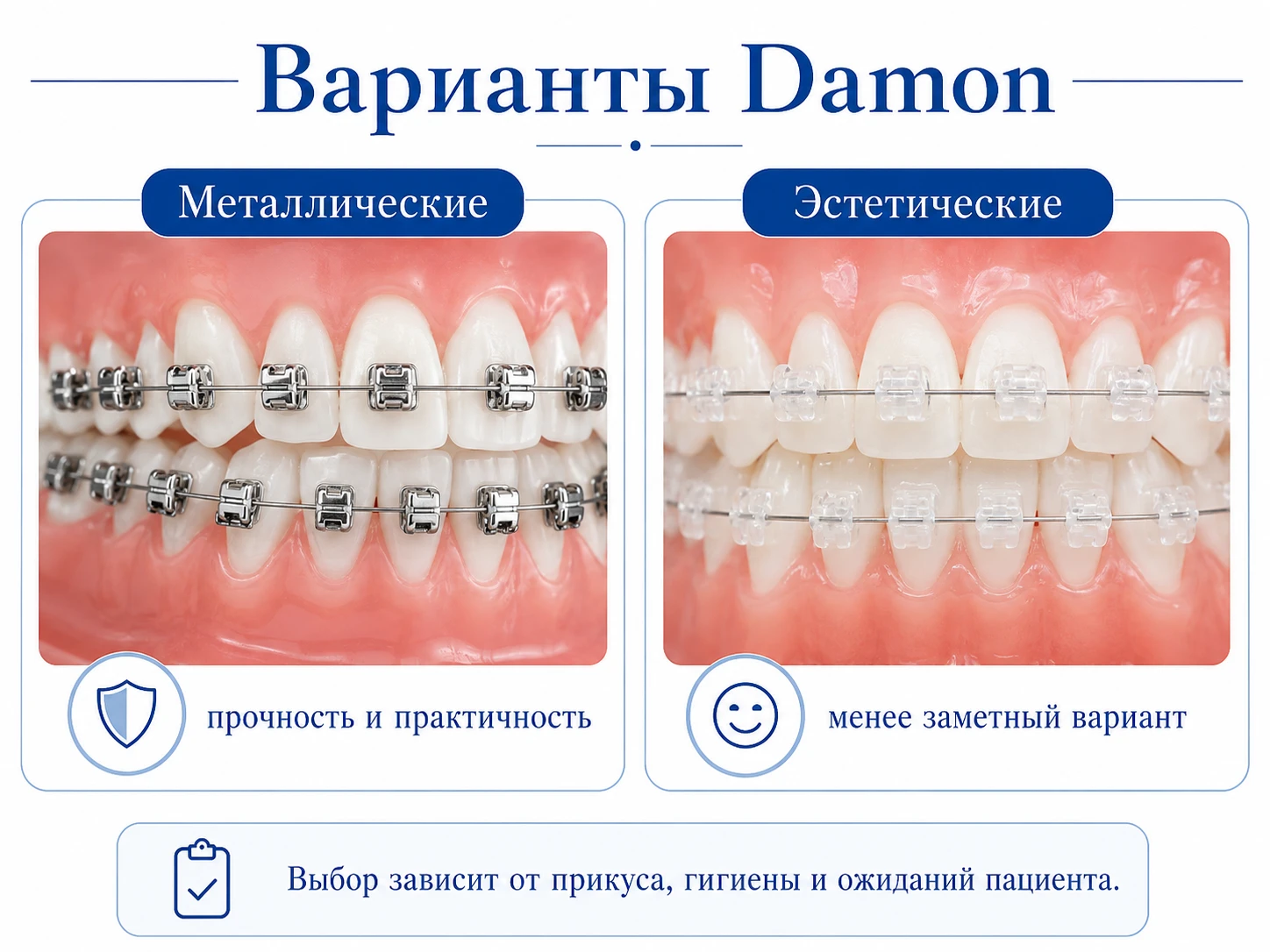 Металлические и эстетические варианты самолигирующих брекетов Damon