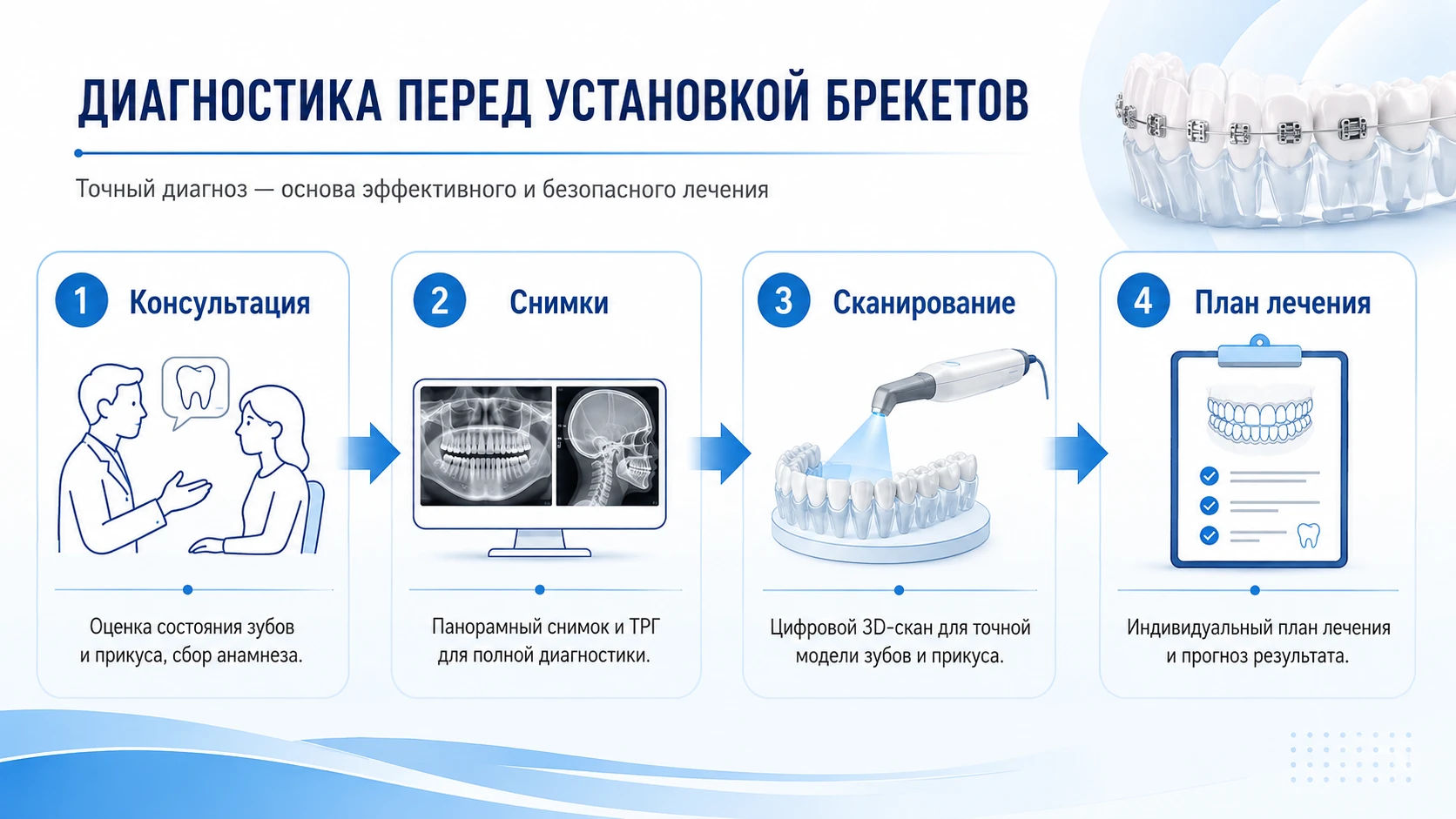 Схема диагностики перед установкой брекетов: консультация, снимки, сканирование и план лечения
