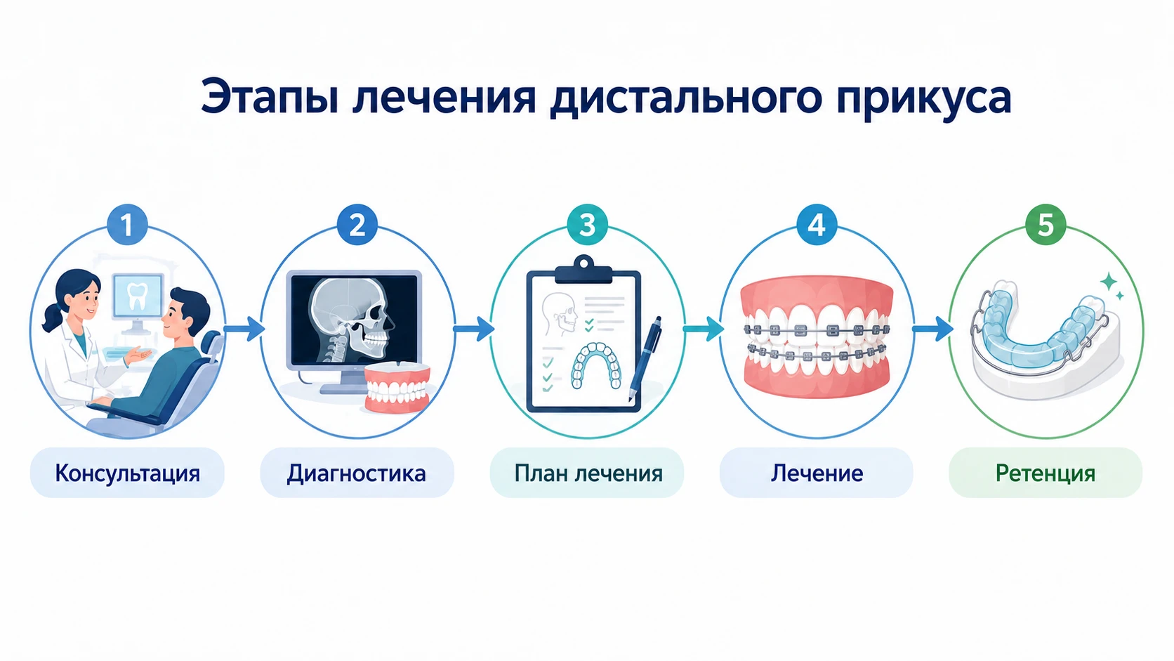 Инфографика этапов лечения дистального прикуса: консультация, диагностика, план, лечение, ретенция