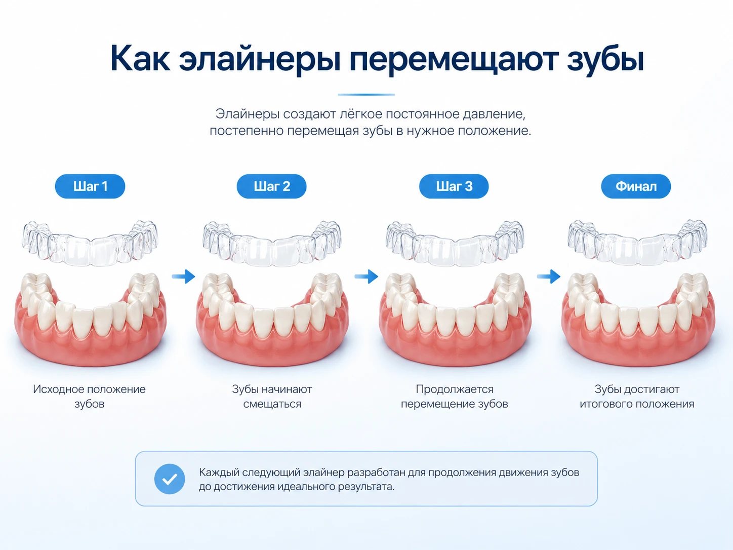 Схема серии кап Invisalign: шаг 1, шаг 2, шаг 3 и финальное положение зубов