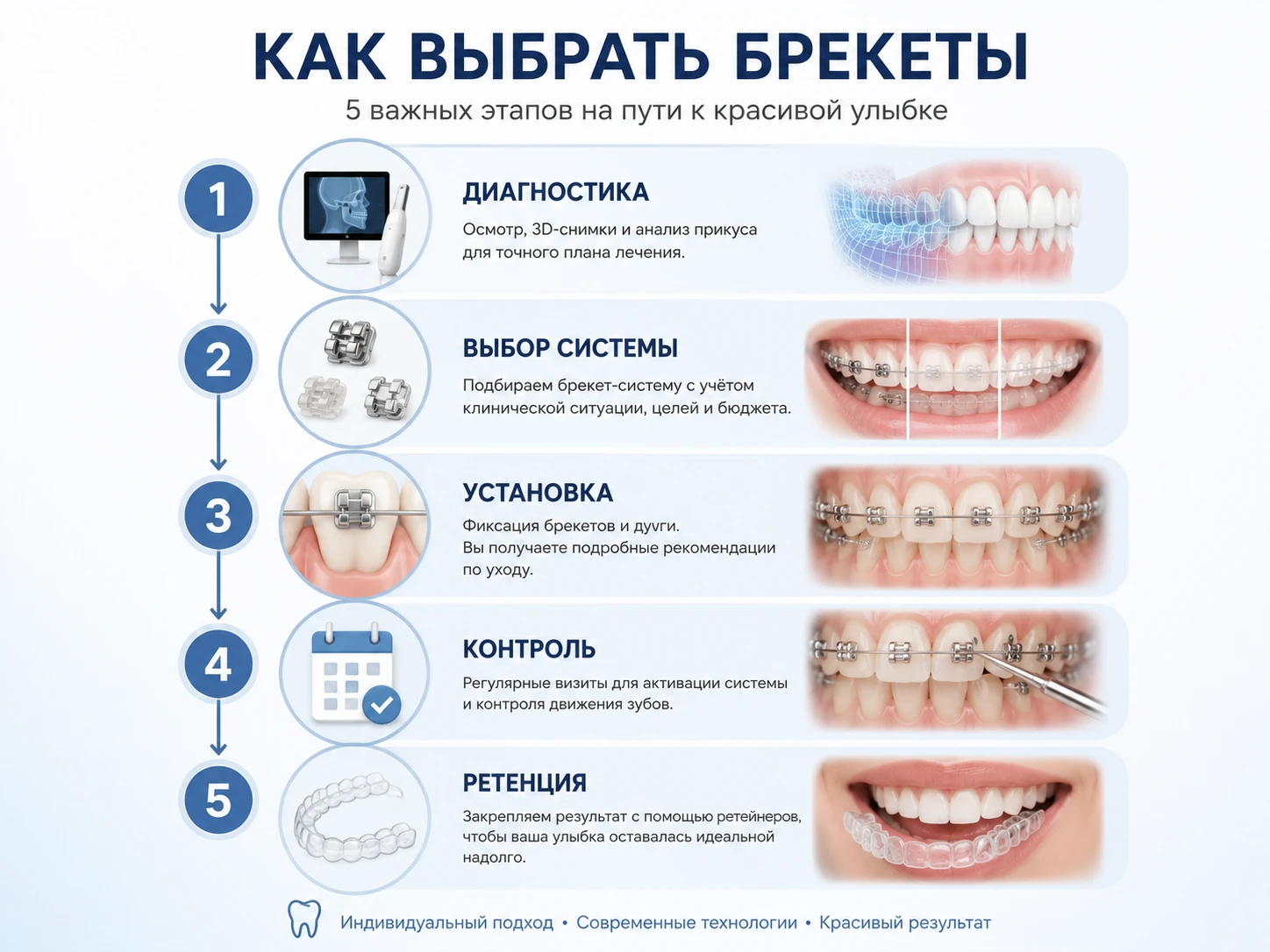 Инфографика выбора брекетов: диагностика, выбор системы, установка, контроль и ретенция
